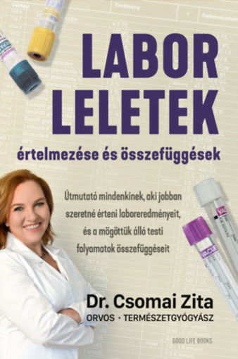 Laborleletek értelmezése és összefüggések termékhez kapcsolódó kép