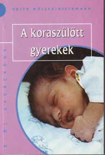 A koraszülött gyerekek termékhez kapcsolódó kép