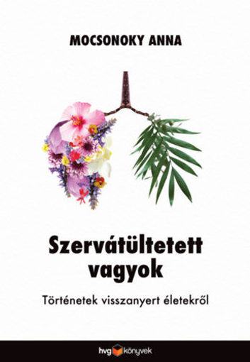 Szervátültetett vagyok - Történetek visszanyert életekről termékhez kapcsolódó kép